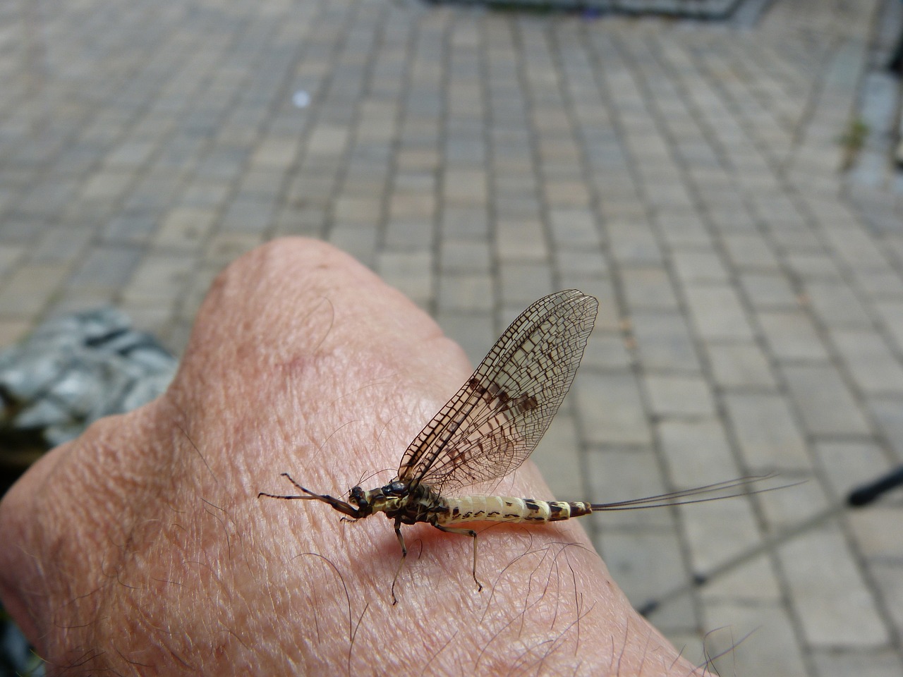 복부 실리프팅